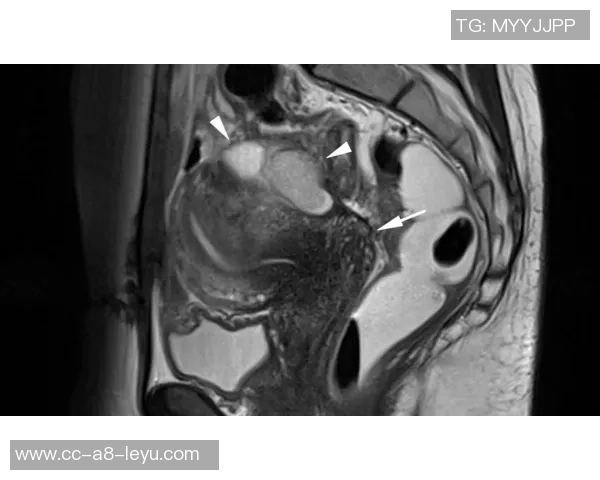 约维奇重摔受伤退场X光检查结果无异常明日将进行MRI检查评估伤情